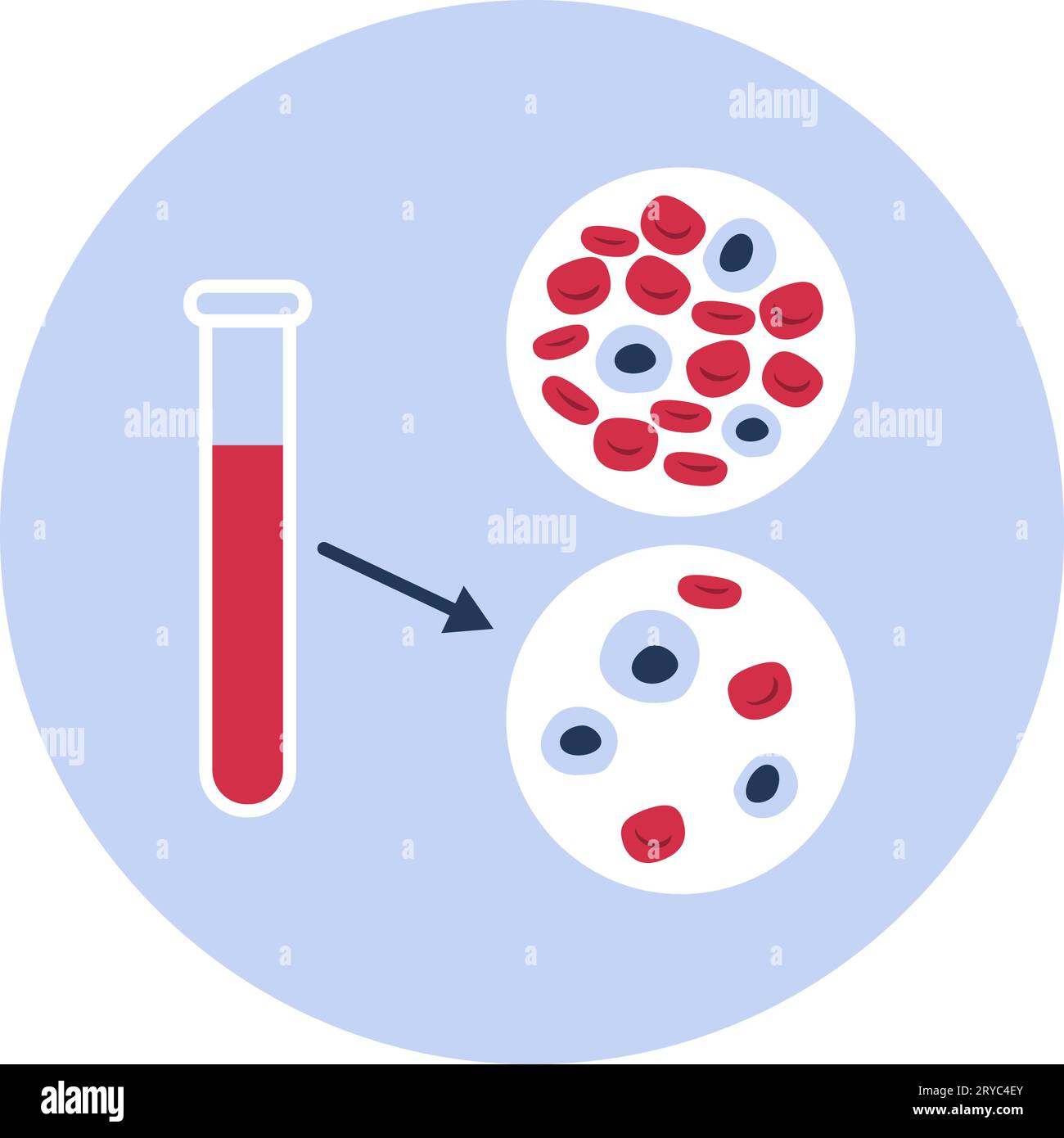 Anämie: Bluttestvergleich zwischen gesundem und anämischem Blut, isoliertes Icon Stock Vektor