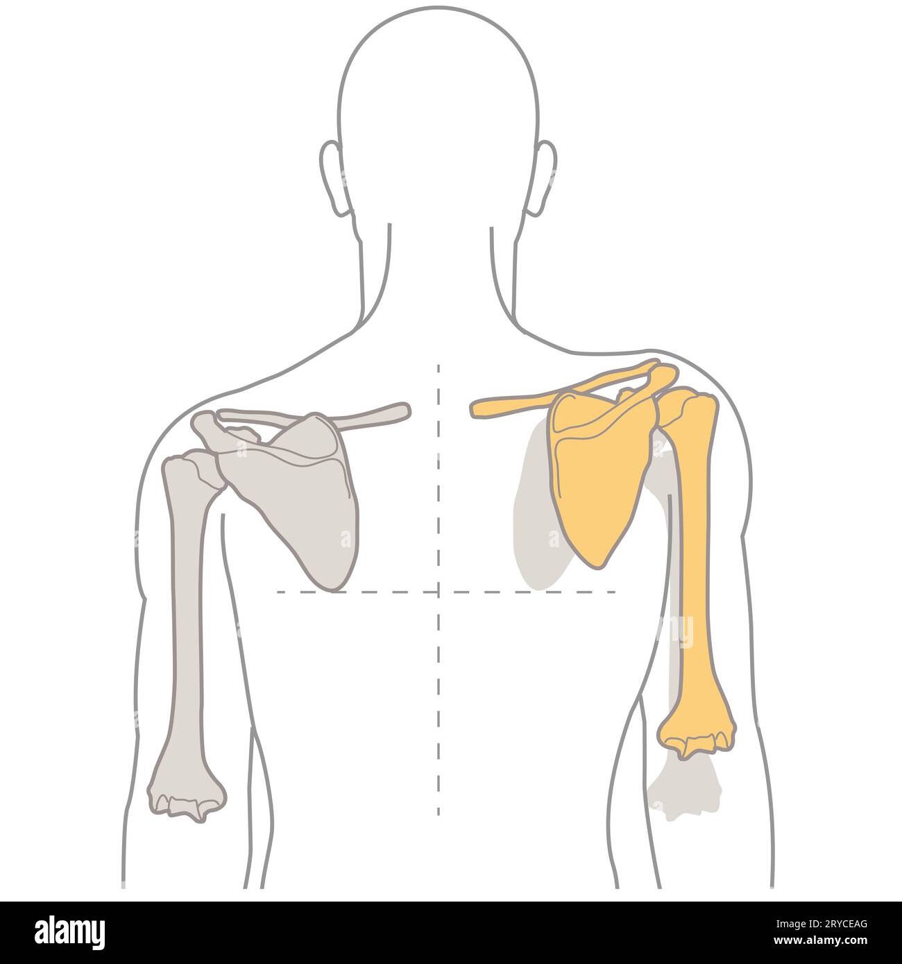 Die Dyskinese der Schulterhöhle ist eine abnorme Bewegung der Schulterblätter, die oft auf Muskelungleichgewichte zurückzuführen ist und zu Schmerzen, Funktionsstörungen und Veränderungen der Schulter führt Stockfoto