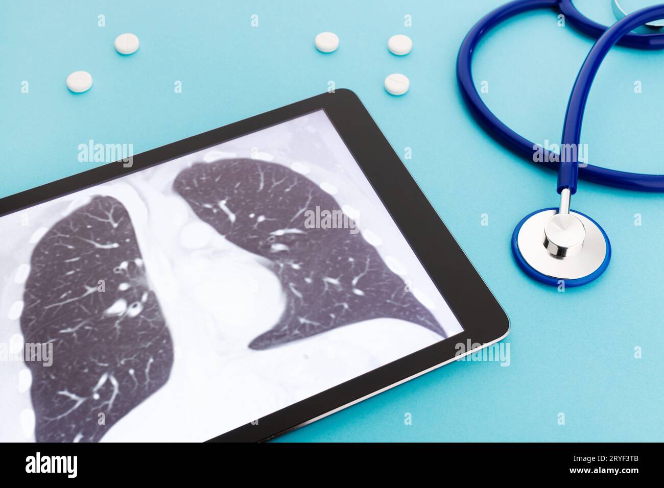 Tablet-Computer mit Lunge-Röntgen und Stethoskop und Pillen auf blauem Hintergrund. Konzept für Lungenerkrankungen Stockfoto