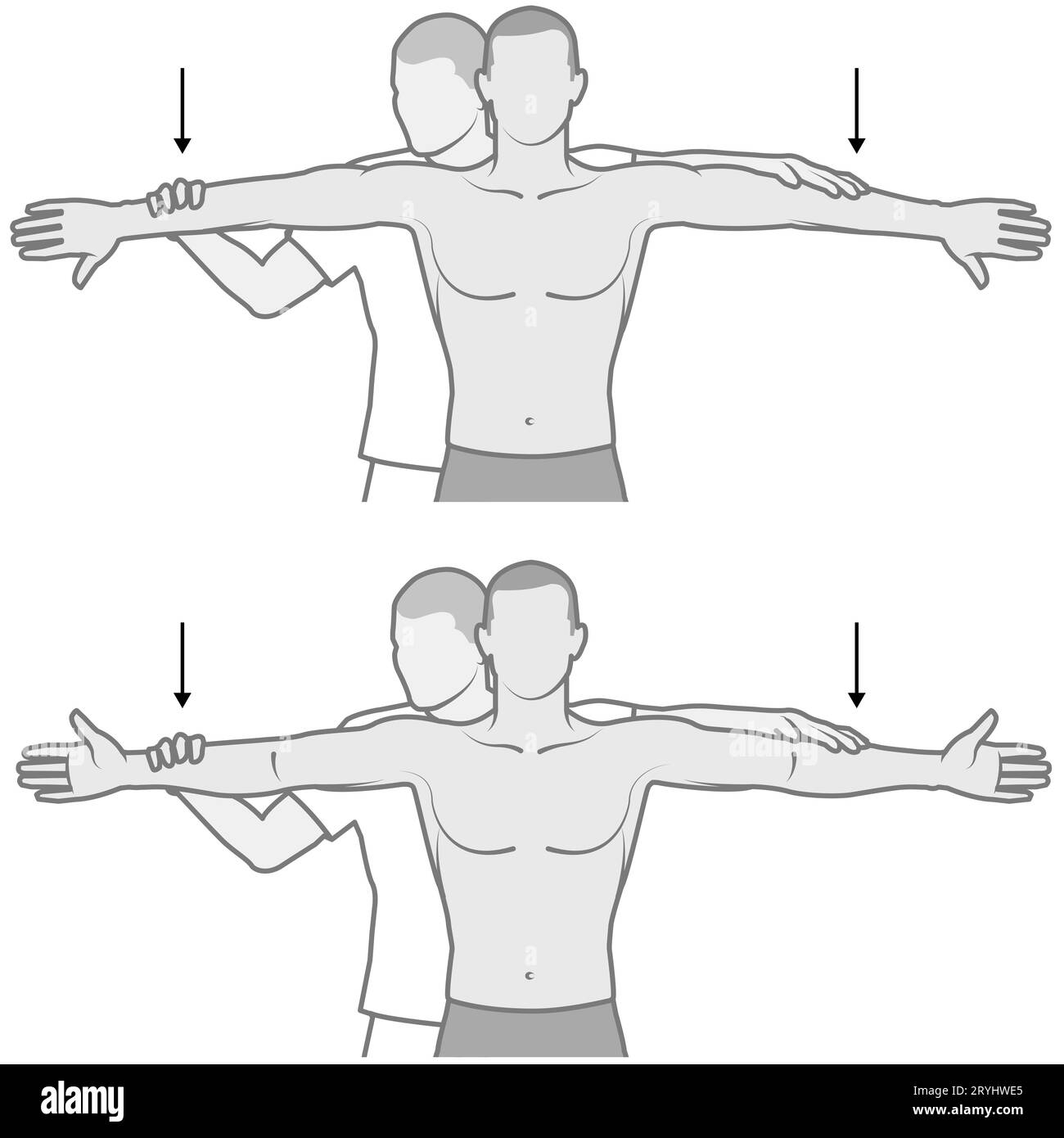 Jobe's Test, auch bekannt als der „leere Dose“-Test, bewertet die Integrität der Schultermuskulatur. Es handelt sich um eine widerstandene Entführung des Arms mit dem Daumen Stockfoto