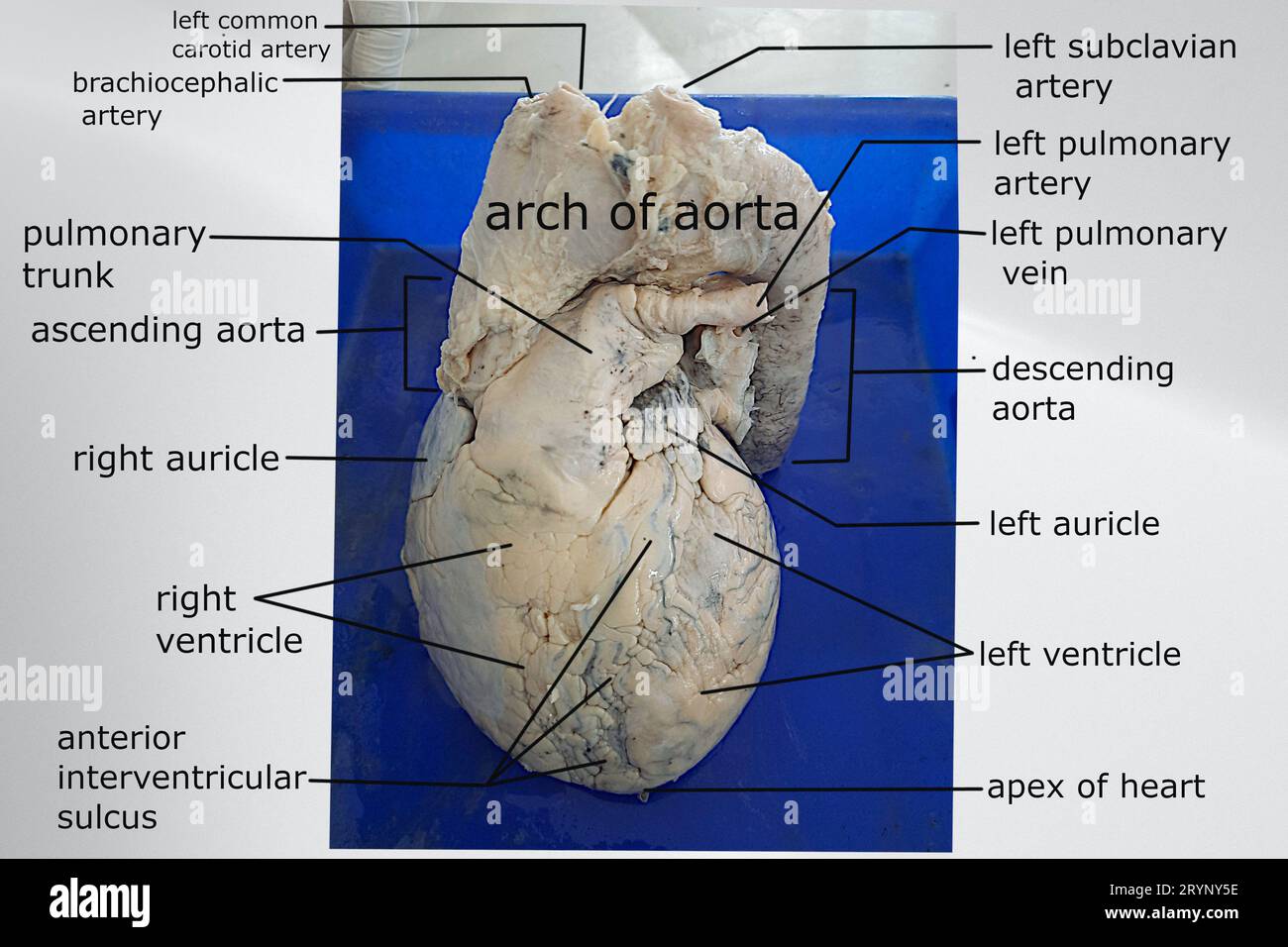 Anatomische Besonderheiten der Vorderansicht des menschlichen Herzens mit angebrachten grossen Gefässen Stockfoto