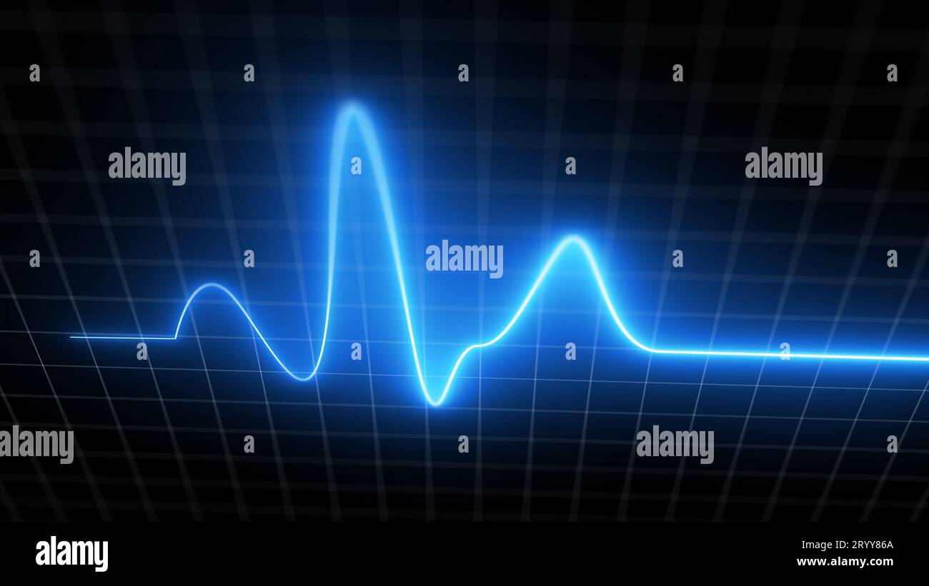 Blauer Herzschlagmonitor EKG-Linienmonitor mit bewegter Kameraverarbeitung Heartthrob-Anzeige. Medizinisches Screening-Diagramm im Elektrokardiogramm Stockfoto