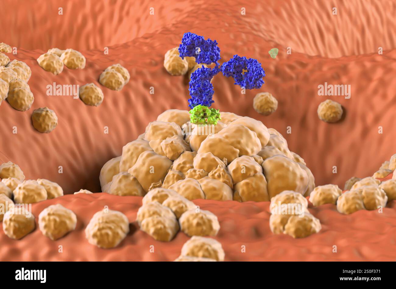 Monoklonale Antikörpertherapie beim Magenkarzinom (Magen) - Nahaufnahme 3D-Illustration Stockfoto