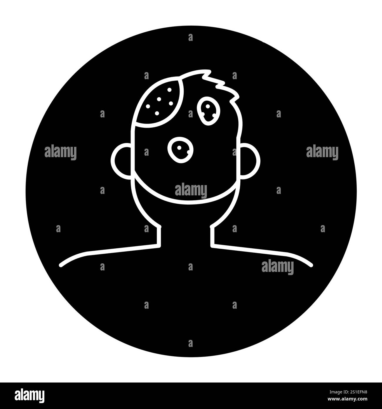 Symbol für Alopecia areata-Farblinie. Autoimmunerkrankungen. Vektorisoliertes Element. Bearbeitbare Kontur. Stock Vektor