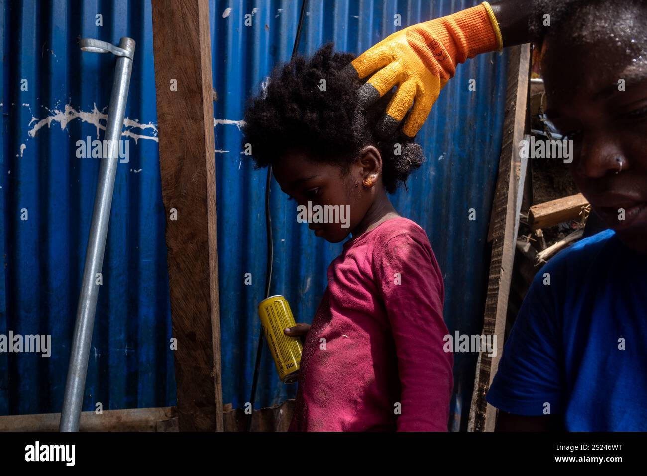 Michael Bunel/Le Pictorium - MAYOTTE, Zyklon Chido - 22/12/2024 - mayotte - Alinayanah, 4 Jahre alt, leidet an Impetisläsion. Sie lebt mit ihrer Familie im Kaweni-Slum. Sein Zustand erfordert Medikamente, einschließlich Antibiotika, die sich die Familie nicht leisten kann. Kaweni Slum. Dezember 2024. Mamoudzou, Mayotte. Die Insel Mayotte ist nach dem Durchzug des Zyklons Chido am 14. Dezember verwüstet. Die Bevölkerung der Slums aus der komorischen Einwanderung, die bereits vor dem Durchzug des Wirbelsturms Arm war, beklagt sich über die fehlende Hilfe. „Es ist Essen und Trinken, das W Stockfoto