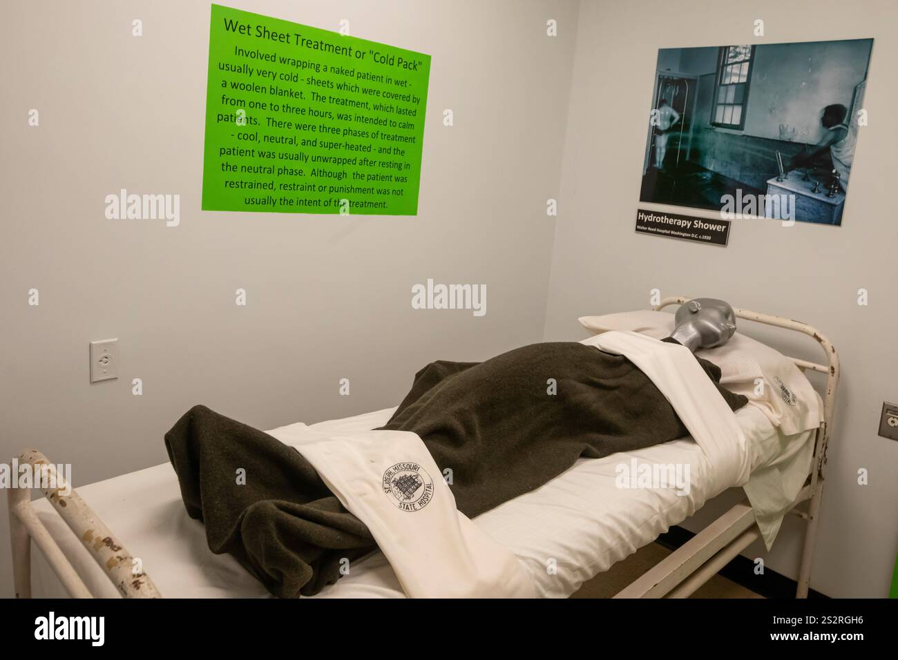 St. Joseph, Missouri: Im Glore Psychiatric Museum werden nasse Laken oder kalte Verpackungen behandelt. Das Museum dokumentiert die Behandlung des Geistes Stockfoto