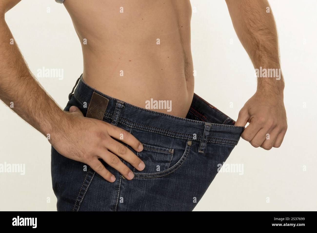 Ein Mann hat mit einer erfolgreichen Diät viel Körpergewicht verloren. Österreich Stockfoto