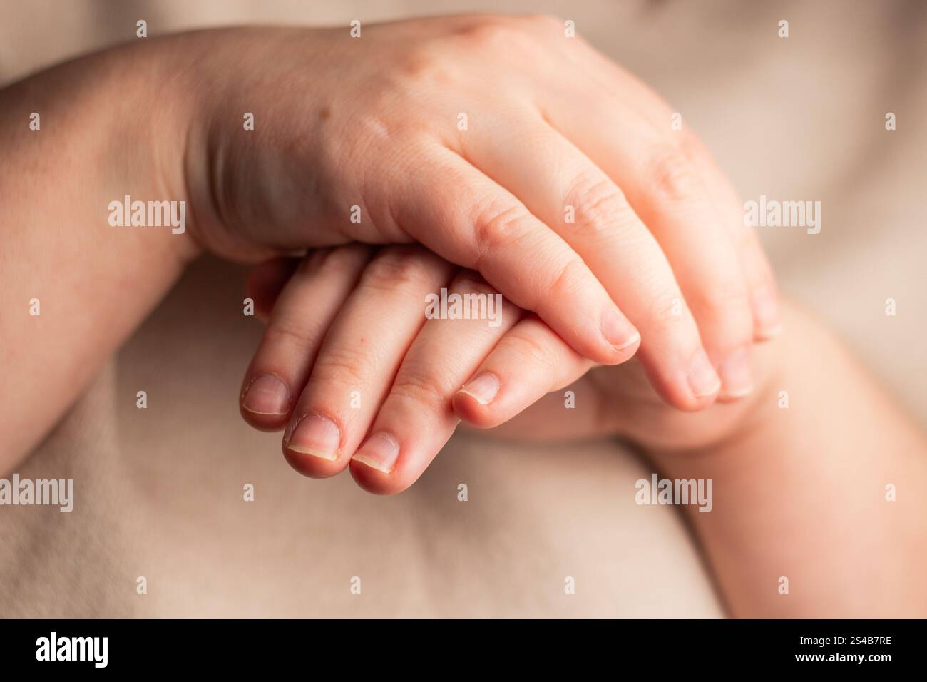 Frau zeigt ihre Hände mit gebissenen Nägeln. Kleine Nagelplatte. Schlechte Maniküre Stockfoto