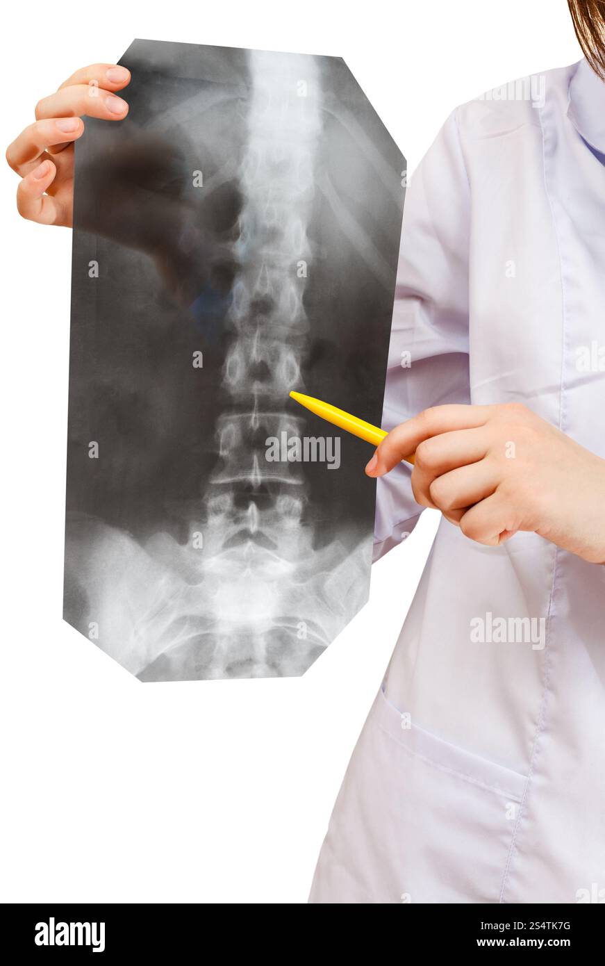 Krankenschwester zeigt Röntgenbild mit menschlichen Wirbelsäule isoliert auf weißem Hintergrund Stockfoto