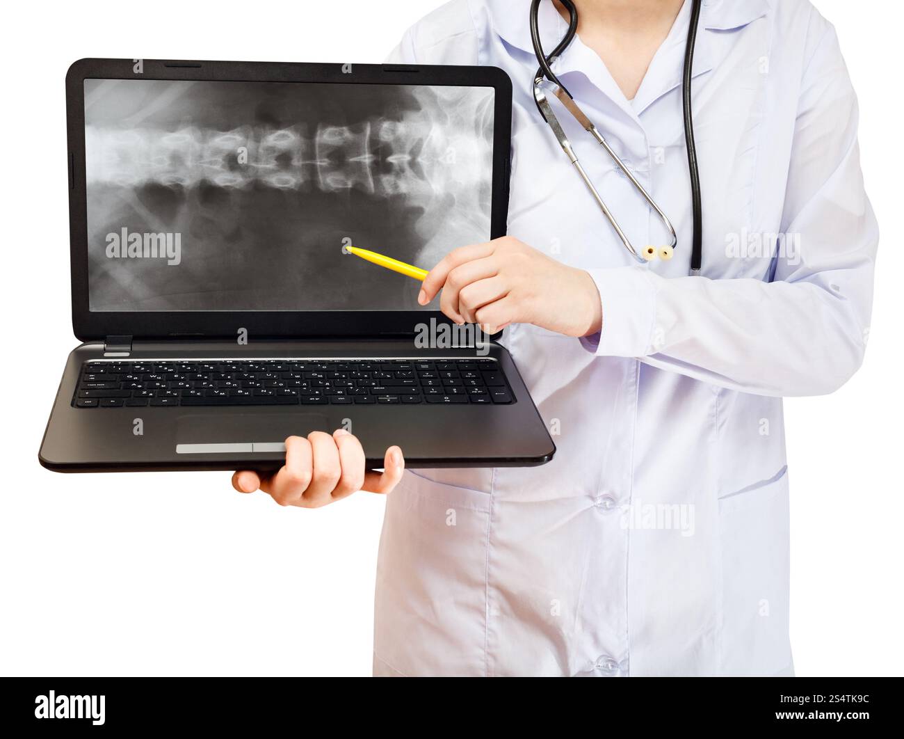 Krankenschwester Punkte auf Computer Laptop mit Röntgenbild der menschlichen Wirbelsäule auf Bildschirm isoliert auf weißem Hintergrund Stockfoto