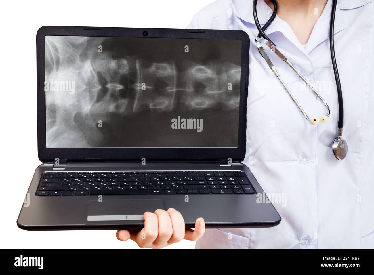 Krankenschwester hält Computer Laptop mit Röntgenbild der menschlichen Wirbelsäule auf Bildschirm isoliert auf weißem Hintergrund Stockfoto