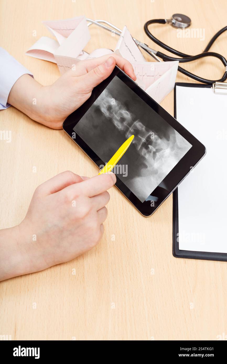 Arzt untersucht Röntgenbild der menschlichen Wirbelsäule auf TabletPC Stockfoto