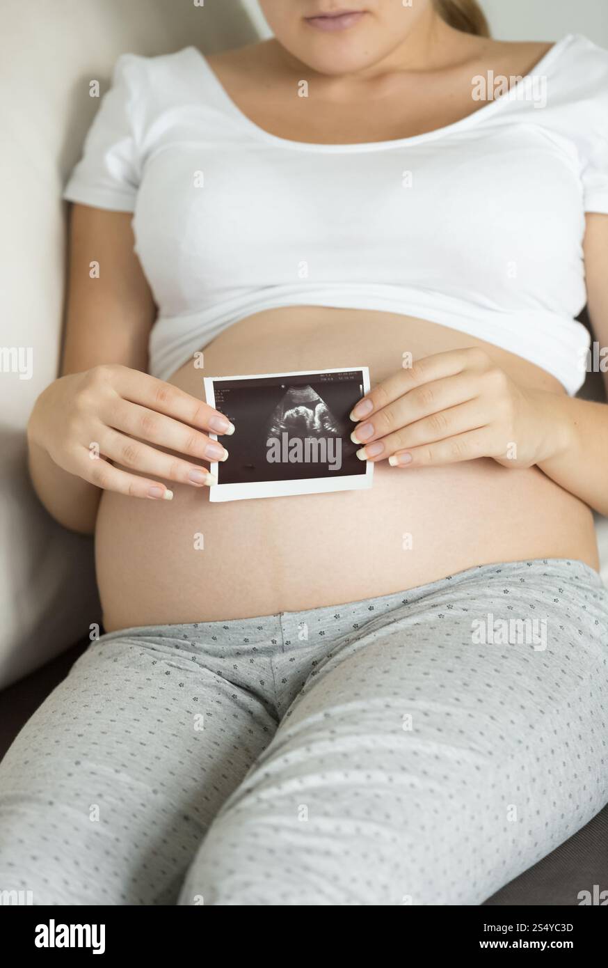Nahaufnahme einer schwangeren Frau mit Ultraschallaufnahme Stockfoto