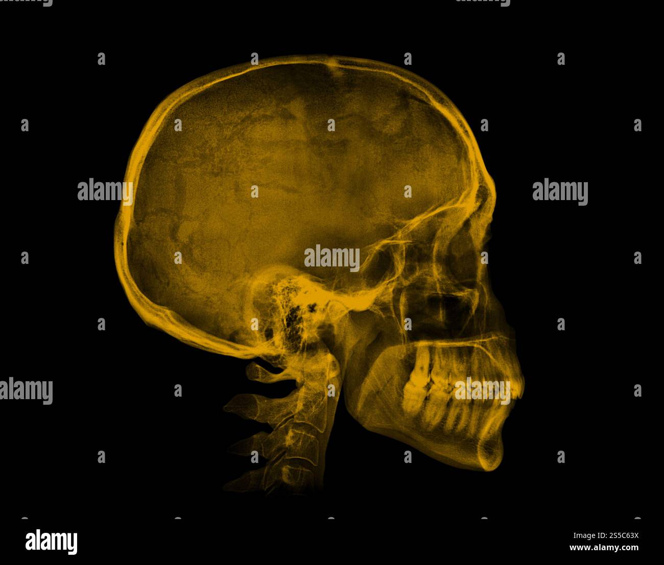 Menschlicher Schädel. Gelbes Röntgenbild isoliert auf schwarzem Hintergrund. Menschlicher Schädel. Gelbes Röntgenbild auf schwarzem Hintergrund Stockfoto