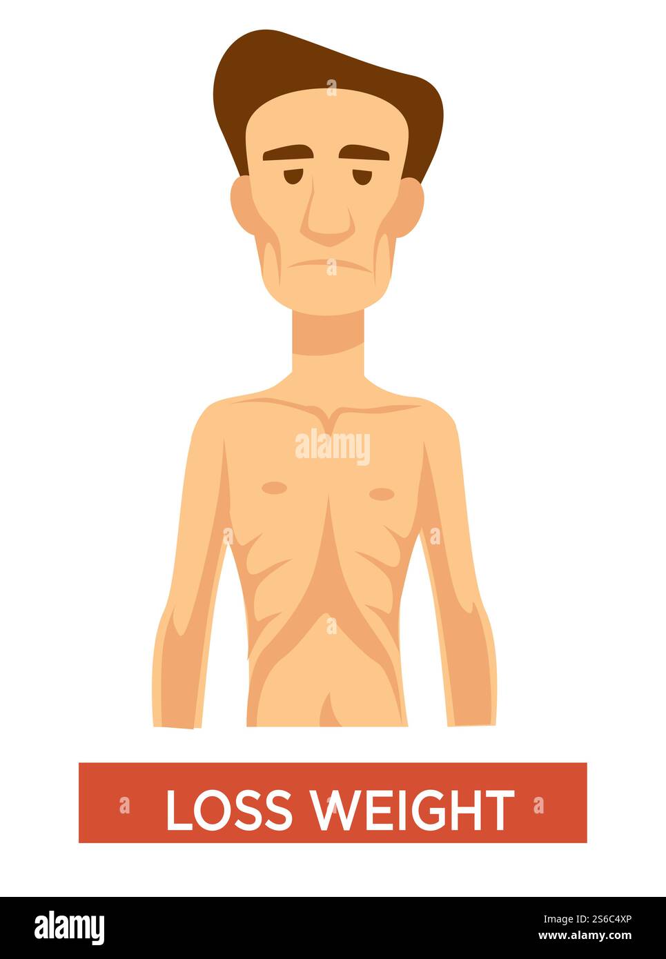 Tuberkulosesymptom, Gewichtsverlust, kranker Mann mit Anorexie isolierter männlicher Charaktervektor. Medizin und Gesundheitswesen, Lungenerkrankungen, Patient mit dünner Figur. Infektion und schlechte Ernährung. Gewichtsverlust, Tuberkulose-Symptom, Mann mit Anorexie, Lungenerkrankung Stock Vektor