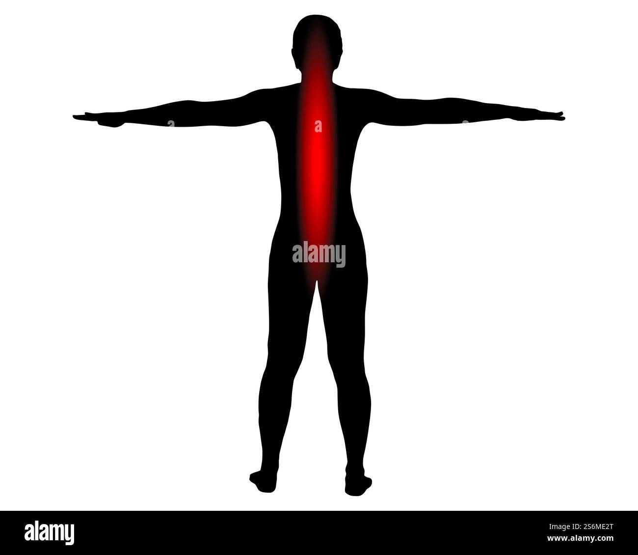 Rückansicht einer Frau mit Symbol für Rückenschmerzen Stockfoto