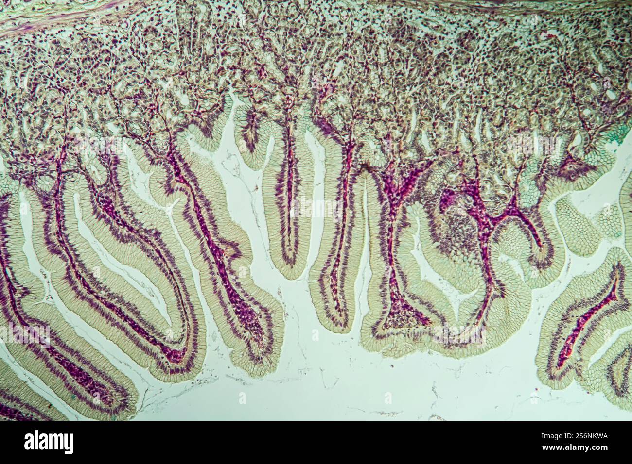 Intestinales erkranktes Gewebe unter dem Mikroskop 100x Stockfoto