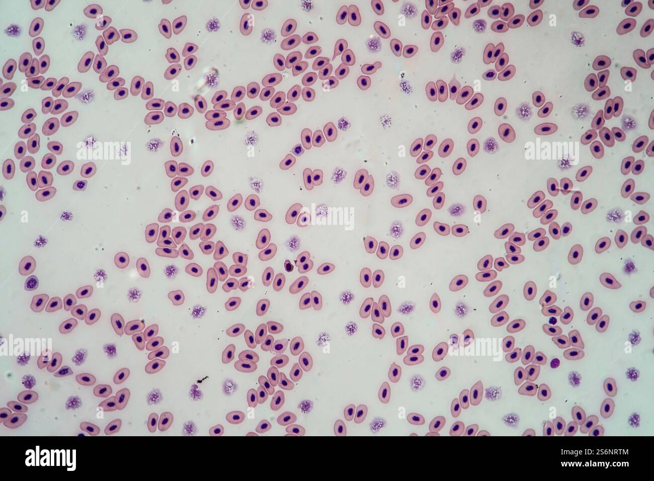 Blutzellen mit Zellkernen 200x Stockfoto
