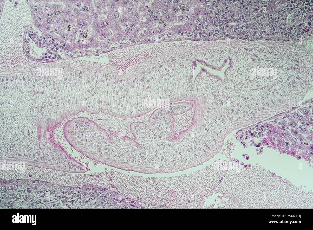 Schistosomiasis erkranktes Gewebe 100x Stockfoto