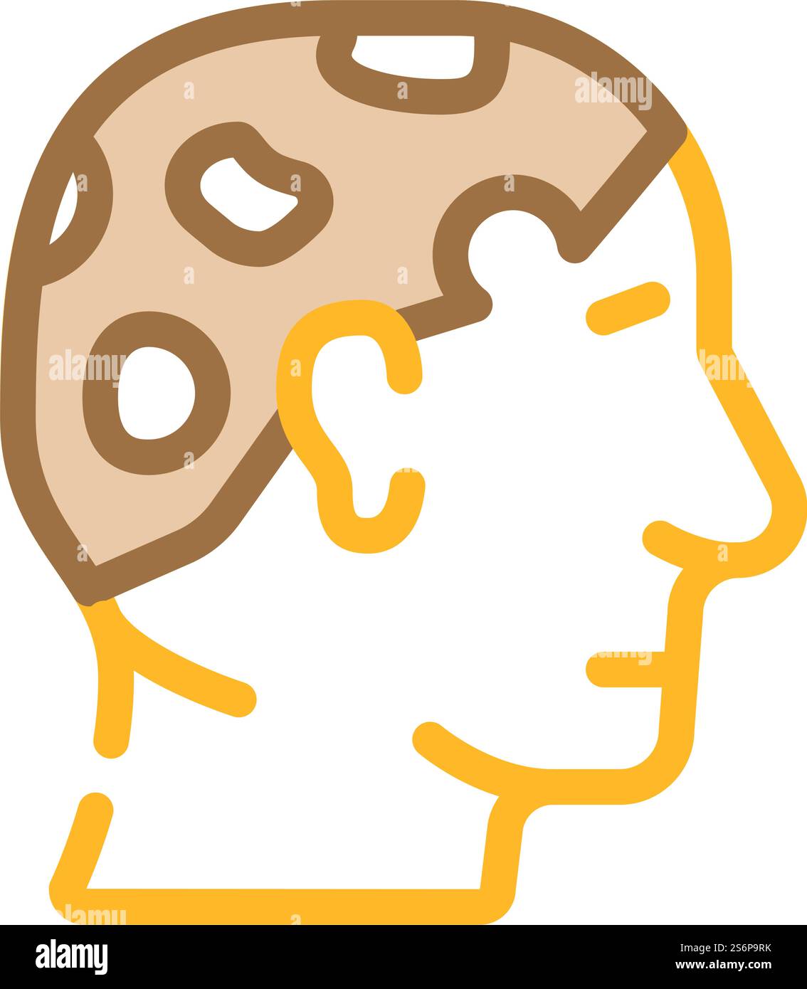 Alopecia areata Farbsymbolvektor. Alopecia areata-Zeichen. Isolierte Symboldarstellung. Alopecia areata Farbe Symbol Vektor Illustration Stock Vektor