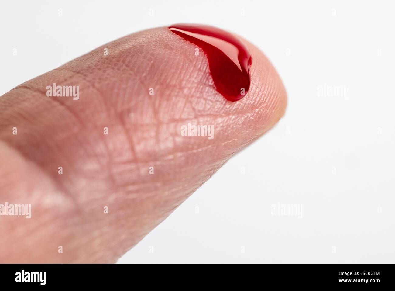 Bluttropfen aus der Fingerspitze, kleine Blutprobe, Kapillarblut, weißer Hintergrund, Stockfoto