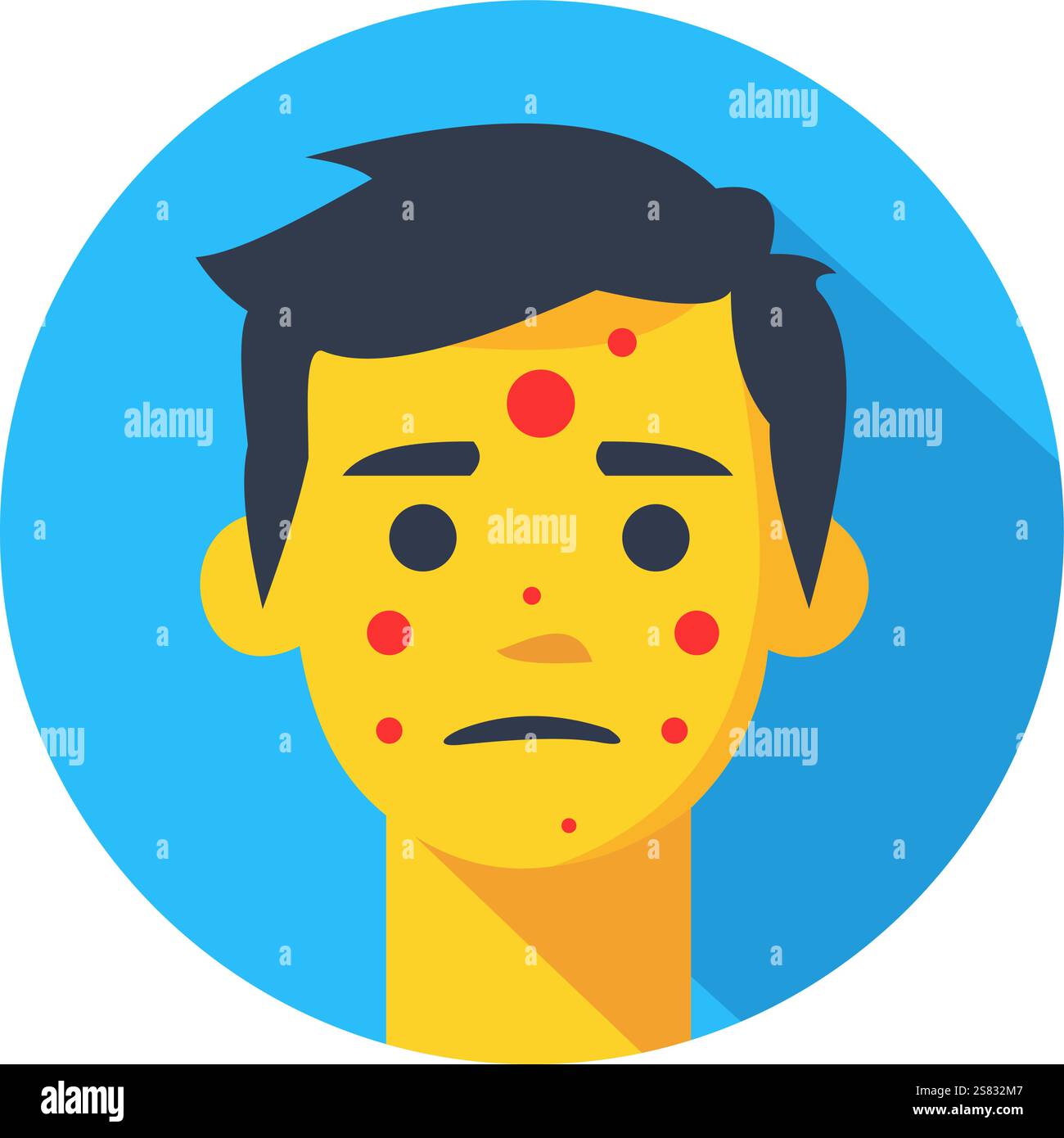 Trauriger junger Mann mit Akne und roten Flecken im Gesicht, symbolisiert Hautprobleme, Dermatologie, Gesundheit, Selbstwertprobleme Stock Vektor