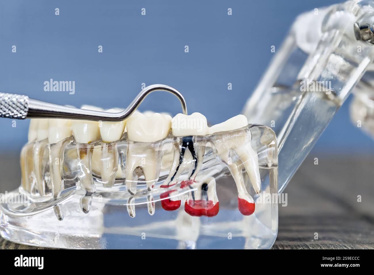 Detailliertes Zahnanatomiemodell mit Metallinstrument, das Wurzelkanalstruktur und Zahn demonstriert Stockfoto