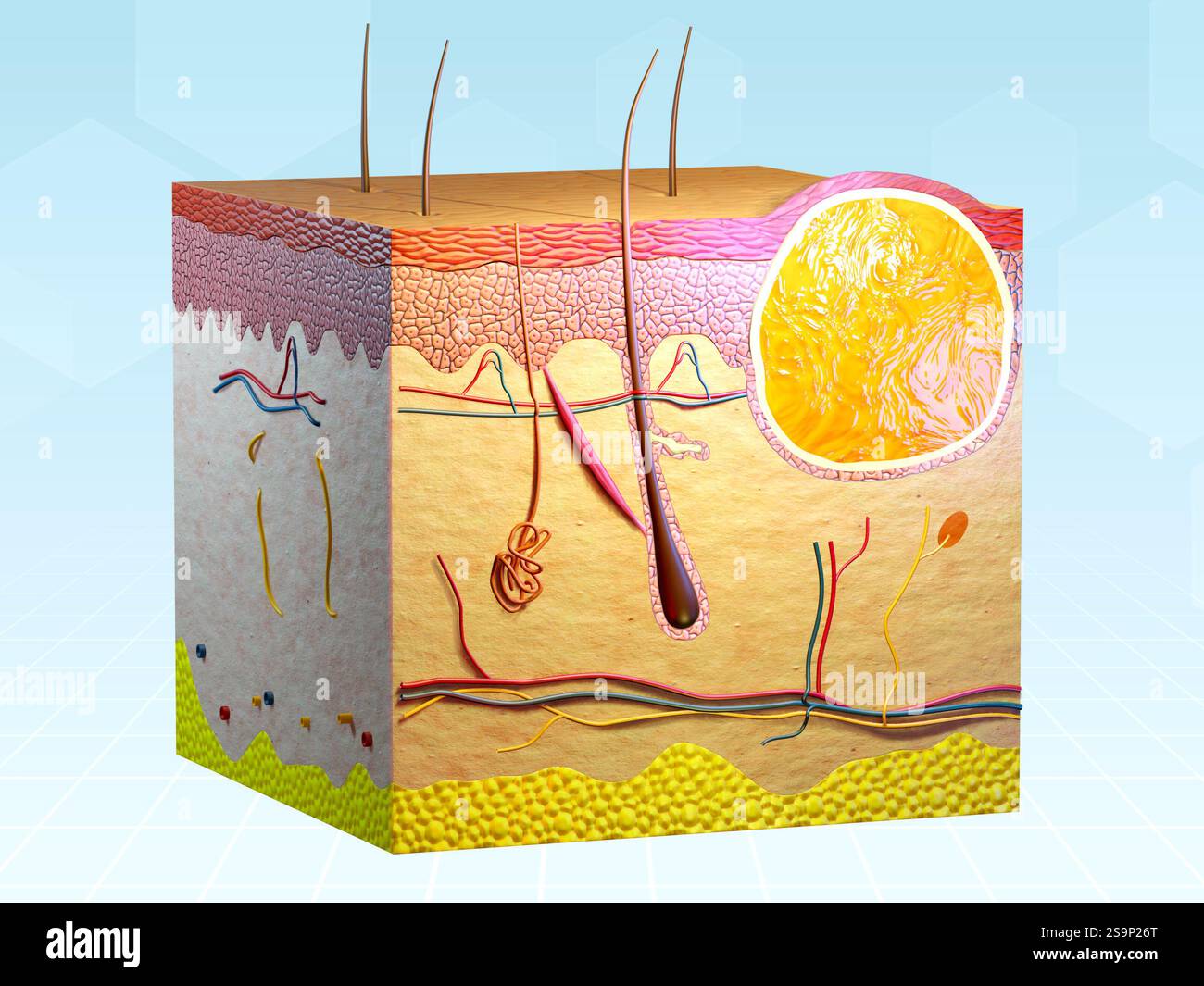 Querschnitt menschlicher Haut mit Talgzyste. Digitale Illustration, 3D-Rendering. Stockfoto