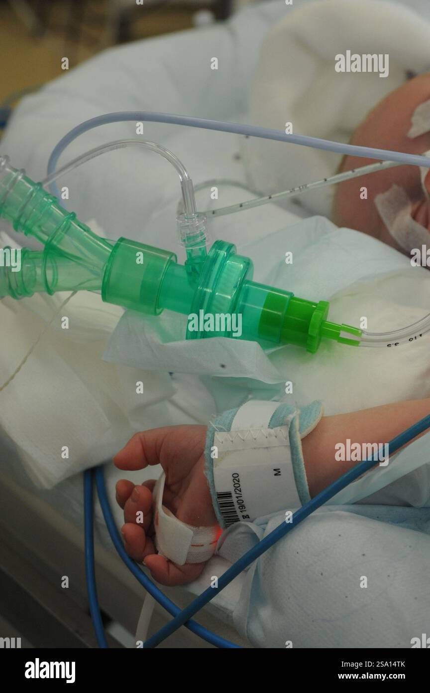 Die Allgemeinanästhesie eines Kindes im OP. Stockfoto