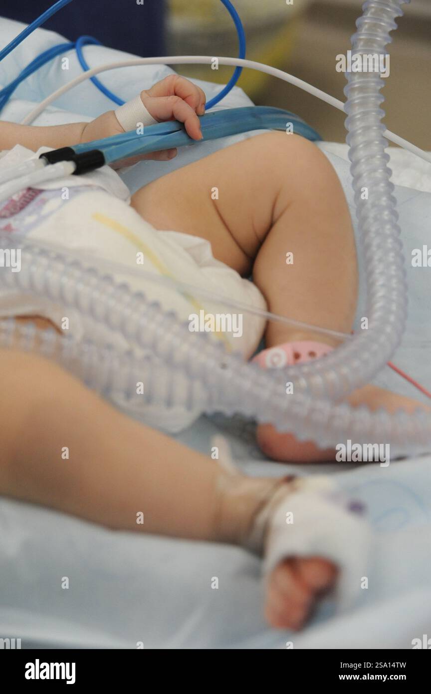 Die Allgemeinanästhesie eines Kindes im OP. Stockfoto