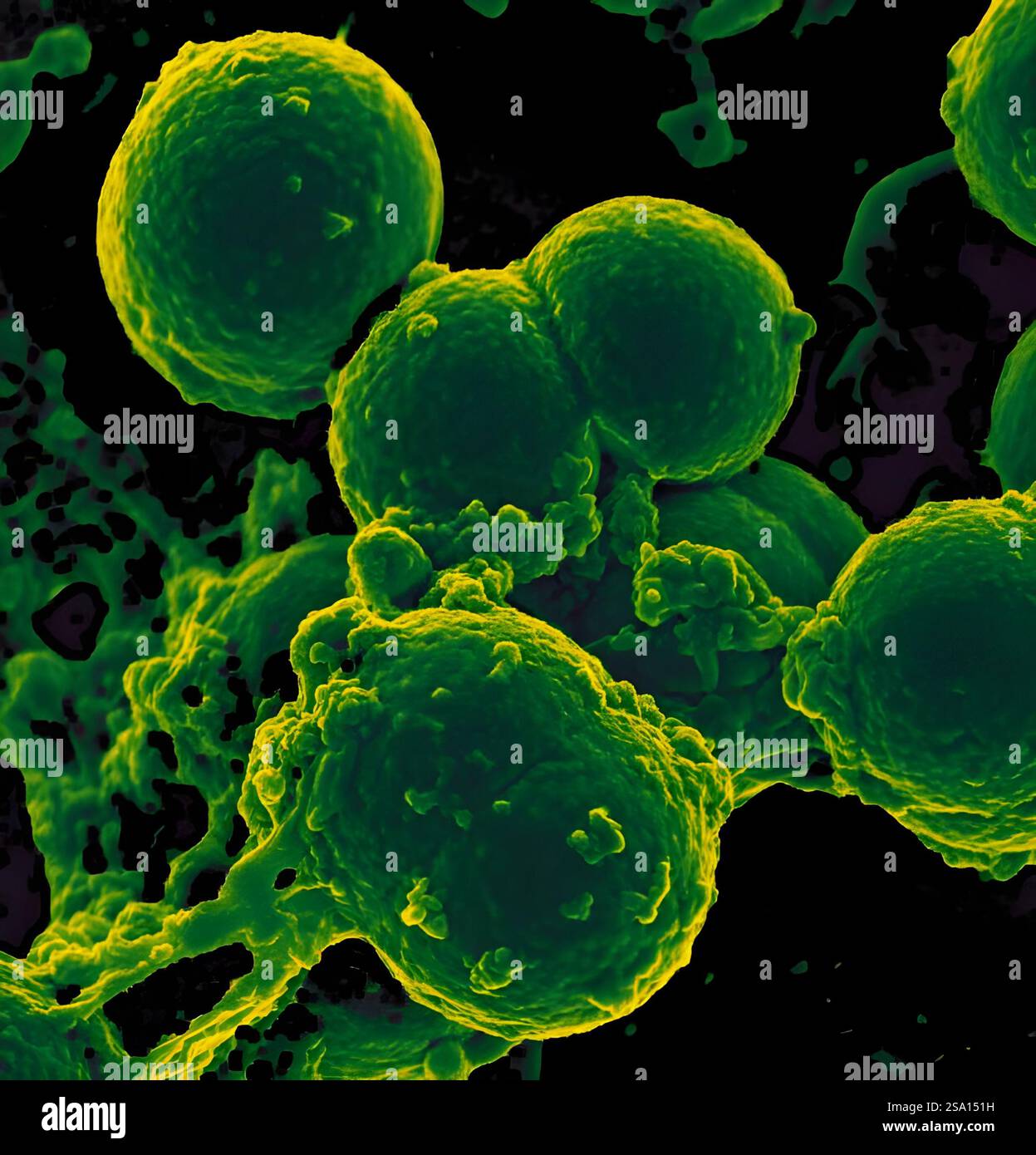 Ron Staph Methicillin resistente staphylococcus aureus bakterien -Fotos und ...