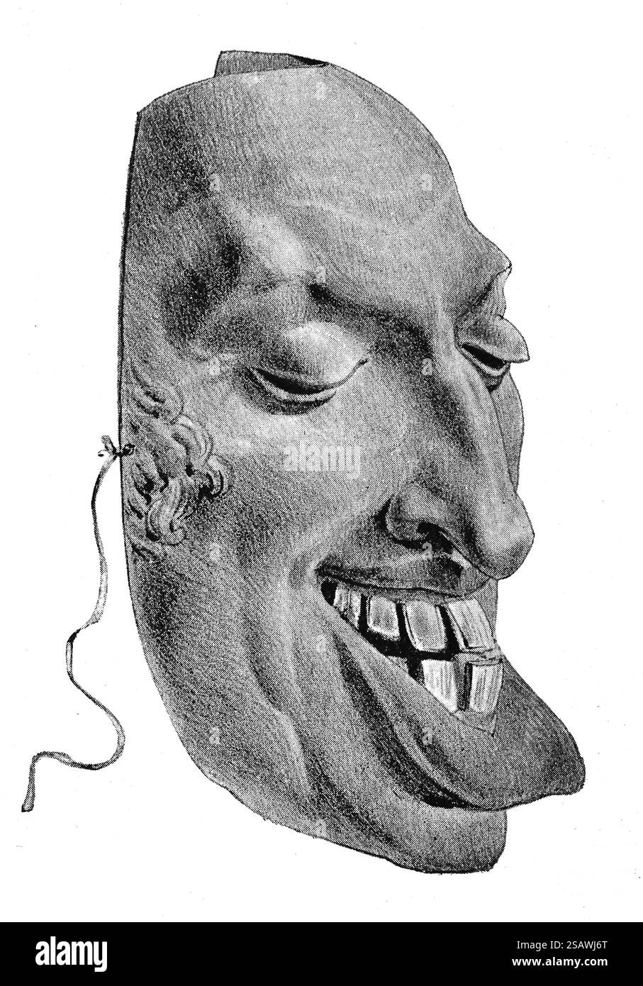 Frankreich. Die Revolution Von 1830. Satirische Maske des Monarchen Karl X. von Frankreich. Karikatur der Zeit. 19. Jahrhundert. Stockfoto