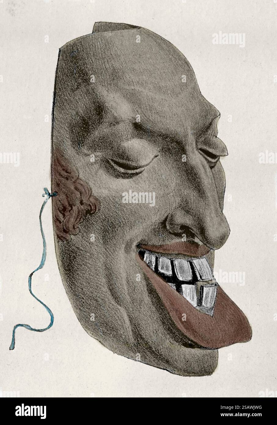 Frankreich. Die Revolution Von 1830. Satirische Maske des Monarchen Karl X. von Frankreich. Karikatur der Zeit. 19. Jahrhundert. Stockfoto