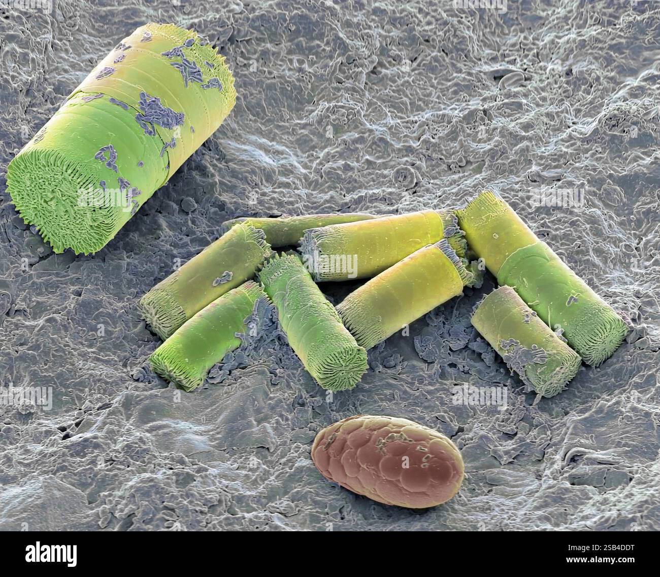 Bodendiatomeen, farbige Rasterelektronenmikrographie (REM). Obwohl die meisten Kieselalgen in aquatischen Lebensräumen vorkommen, kommen spezifische Kieselalgen-Gemeinschaften im Boden vor, wo sie mit anderen Mikroalgen und Cyanobakterien wachsen. Im Bodennahrungsnetz dienen Algen als Nahrung für Bodenprotozoen und Mikro- und Meio-Fauna wie Nematoden oder Collembolans. Es gibt auch eine Muschelamöbe, einzellige (Protozoen) Organismen, die in feuchtem Boden, in Blattstreu und in Pools vorkommen. Vergrößerung: x1600, wenn 10 Zentimeter breit gedruckt. Stockfoto