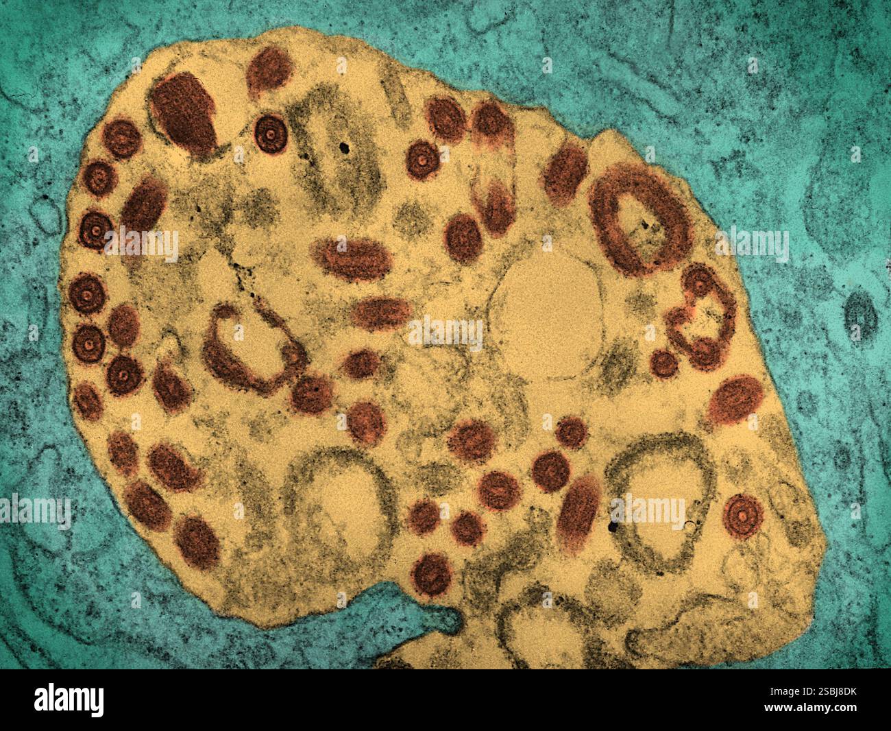 Transmissionselektronenmikroskopische (TEM) Bilder einer nicht offenbarten Gewebeprobe zeigen das Vorhandensein zahlreicher Marburger Viruspartikel. Das Marburg-Virus ist ein hämorrhagisches Fieber-Virus aus der Familie der Filoviridae und ein Mitglied der Art Marburg-Marmarburgvirus. Sie wird als äußerst gefährlich angesehen. Stockfoto
