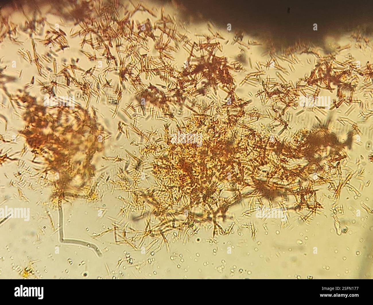 (Buellia albula), Pilze, Chatham-Inseln, Rekohu (Chatham-Insel) Te Whanga, Motuhinahina, Saxicolous auf Te Whanga-Kalkstein. Reichlich vorhanden - wahrscheinlich die häufigste Saxolflechte auf Kalkstein auf dieser Insel. Apothecia variiert viele graue Pruinose, ansonsten stimmt sie mit der Beschreibung dieser Art in der neuseeländischen Flechten 'Flora'-Reihe überein. I+ blaues Hymenium. Dunkel, 1 Septat Sporen mit einer Größe von 12 x 5 Mikrometer. Konvexe Apothecia, zuerst gerahmt und dann bei Reife fehlend Voucher: Determination by A.J. Marshall & D.J. Blanchon (23. Februar 2023). Bilder von A.J. Marshall aus Proben, die am 12. Februar gesammelt wurden Stockfoto