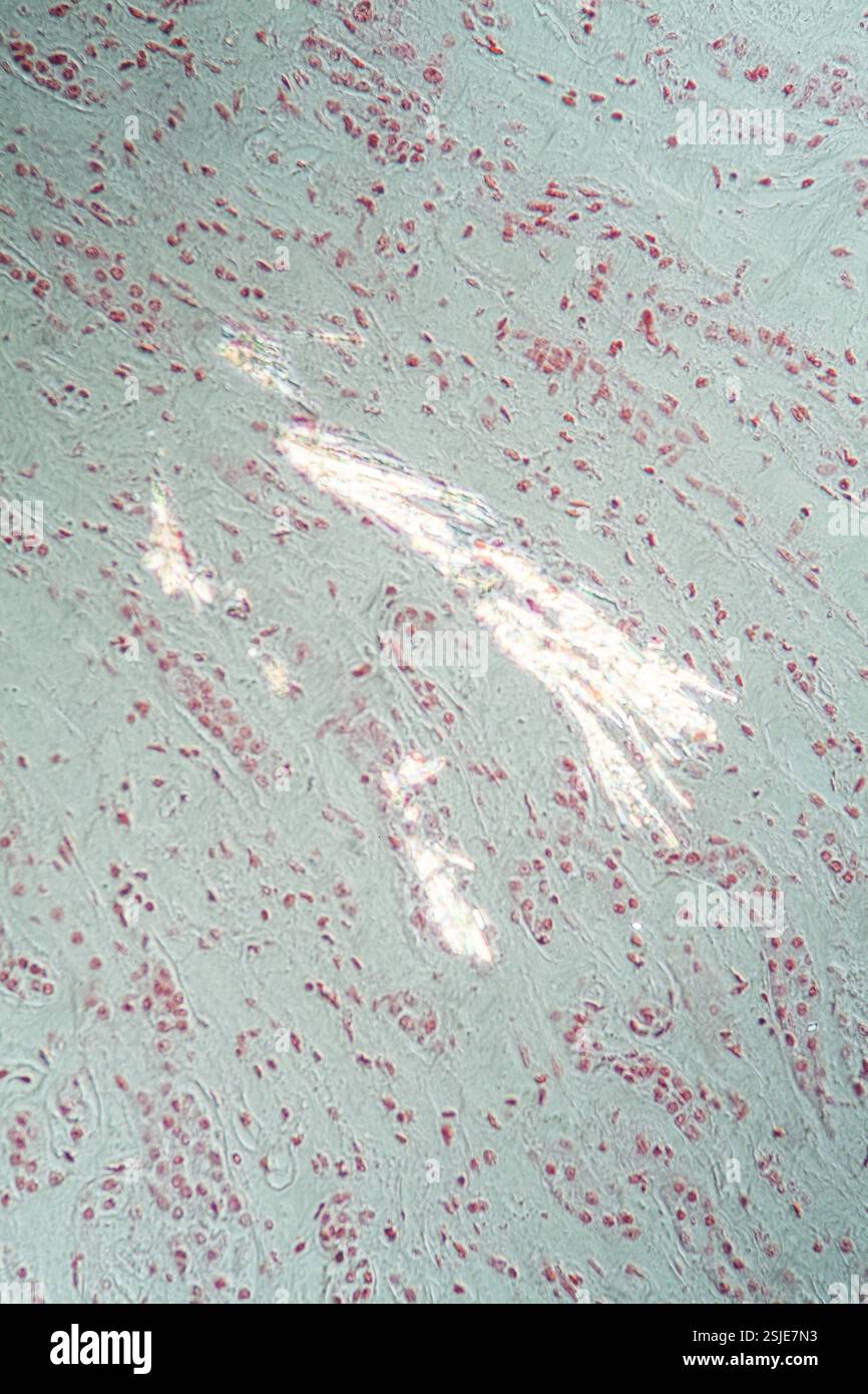 Nierengewebe unter dem Mikroskop 200x Stockfoto