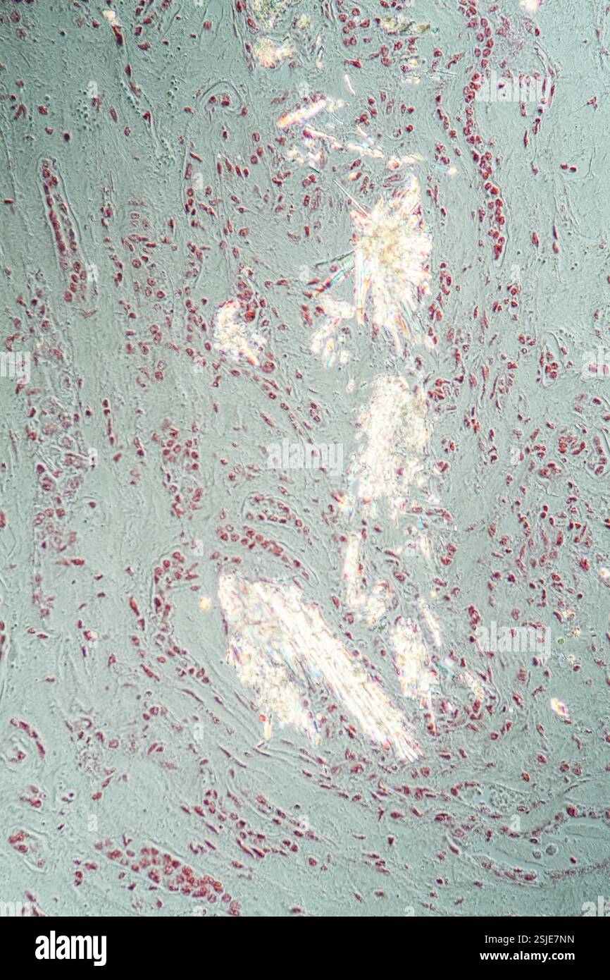 Nierengewebe unter dem Mikroskop 200x Stockfoto