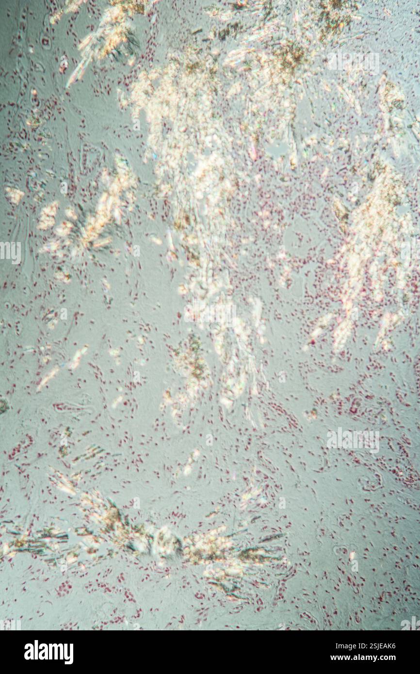 Nierengewebe unter dem Mikroskop 100x Stockfoto