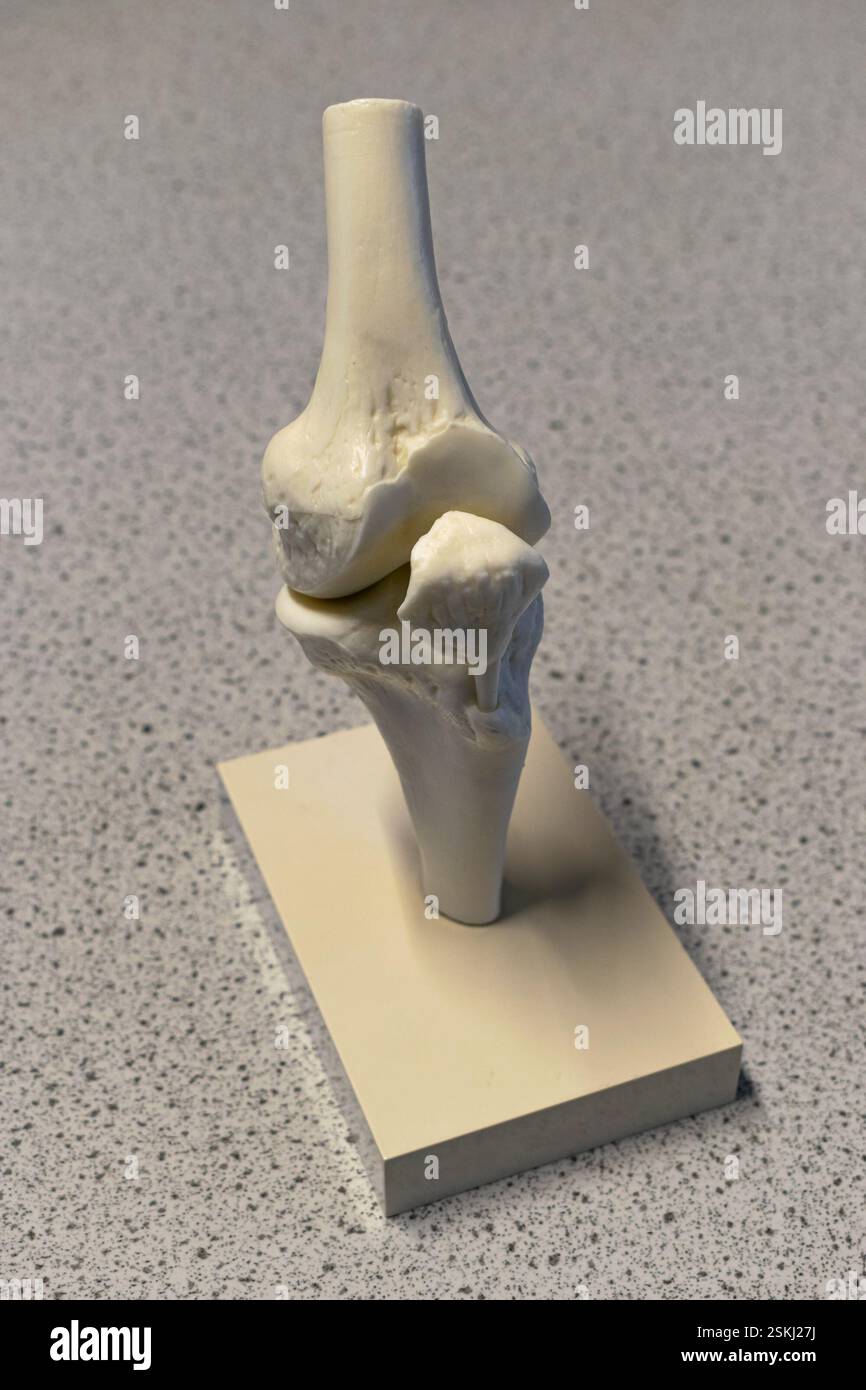 Plastisches Modell eines menschlichen Kniegelenkes. Wird im Biologiekurs in Schulen verwendet oder kann auf dem Schreibtisch eines Arztes gefunden werden. Stockfoto