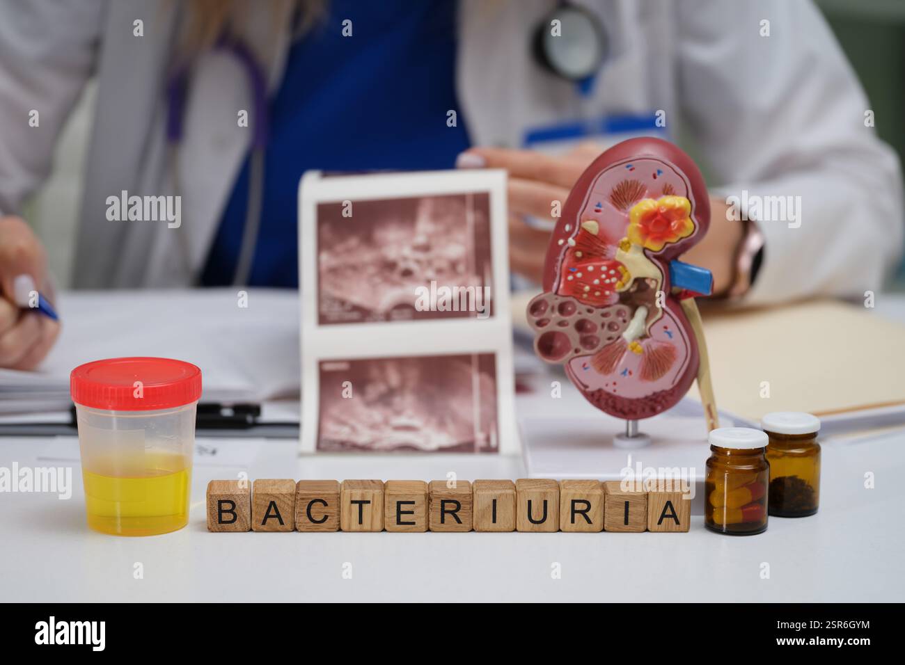 Dieser Text gibt einen Überblick über Methoden zur Diagnose von Bakteriurie mit Nierenmodellen und Laborproben Stockfoto
