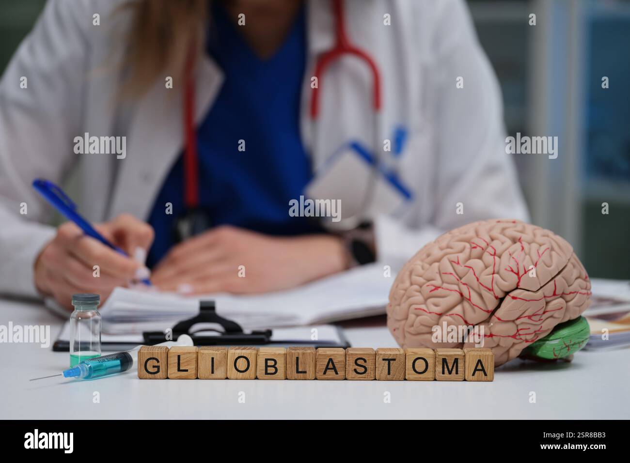 Umfassende medizinische Analyse des Glioblastoms unter Verwendung eines fortgeschrittenen Hirnmodells für die Forschung Stockfoto