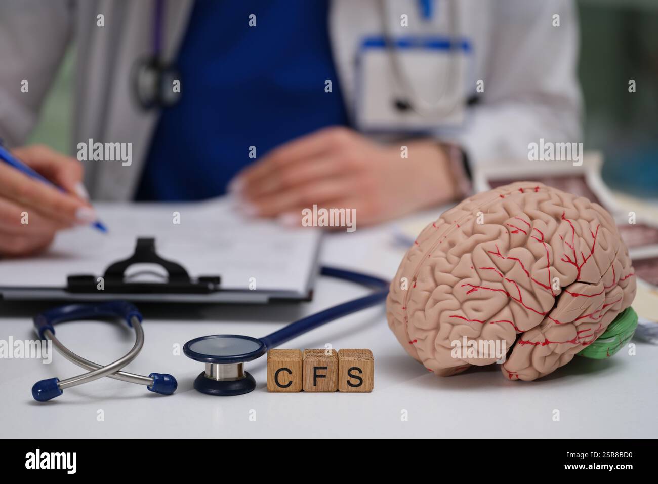 Ein umfassendes Verständnis der klinischen Einflussfaktoren auf das chronische Erschöpfungssyndrom Stockfoto