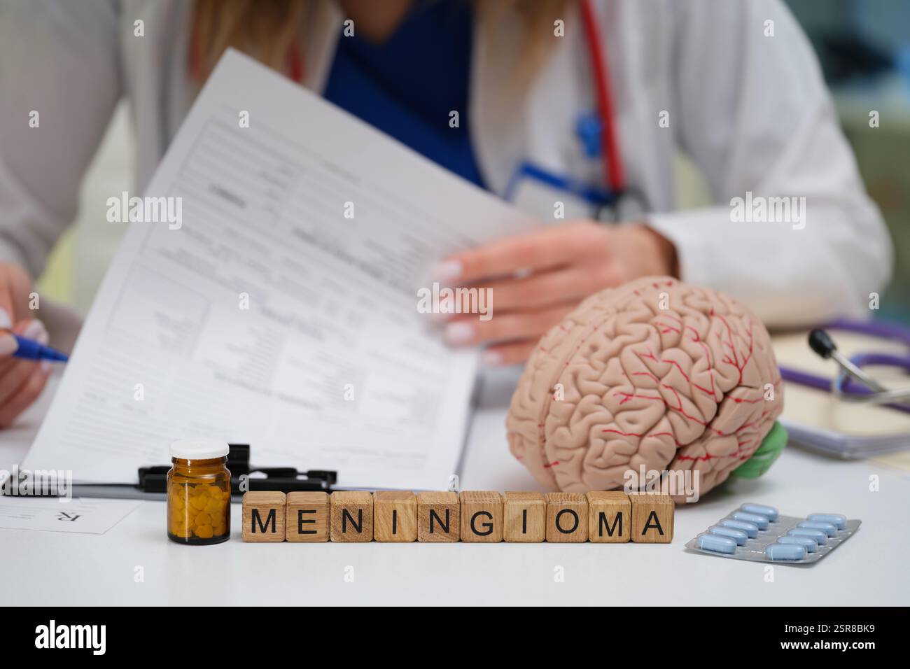 Umfassende medizinische Beratung zum Meningeom unter Verwendung eines fortgeschrittenen Hirnmodells für die Ausbildung Stockfoto