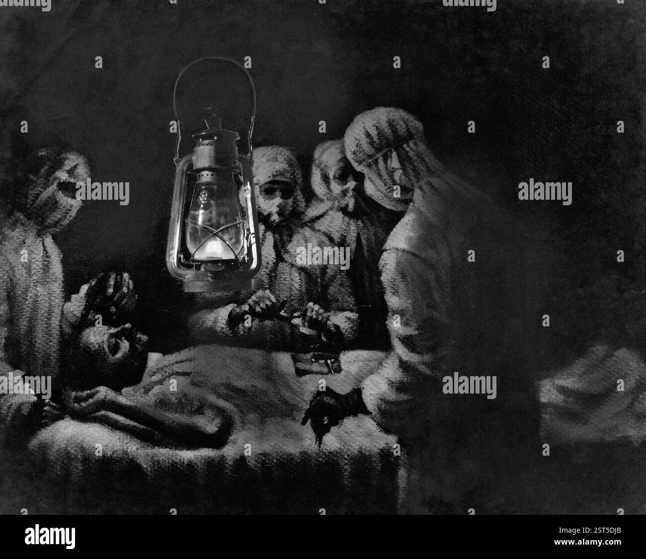 Mahatma Gandhis Appendizitis-Operation, bei der plötzlich der Strom durch die Verwendung von Hurrikan-Lampe, Januar 1924, in Betrieb ging, malend Stockfoto