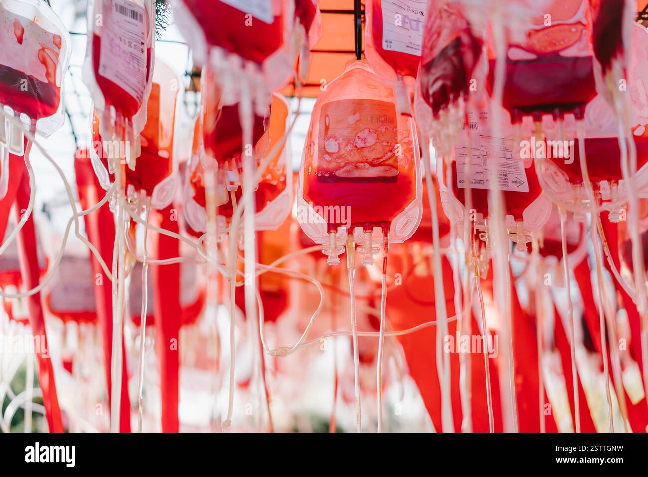 Halb leere Blutbeutel, enger Winkel Stockfoto