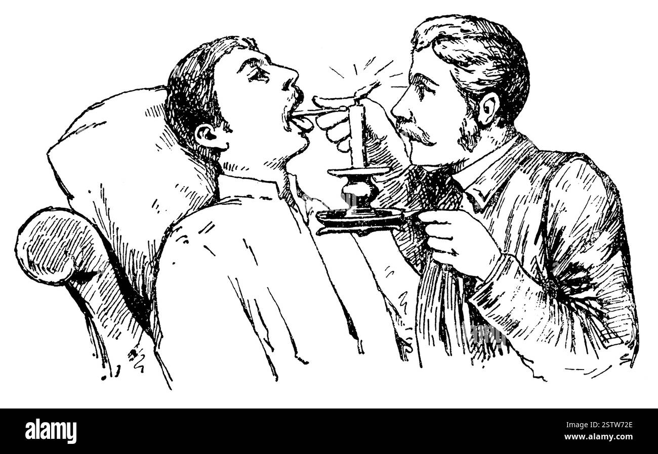 Untersuchung des Rachens. Illustration des 19th. Jahrhunderts. Deutschland. Weißer Hintergrund. Stockfoto