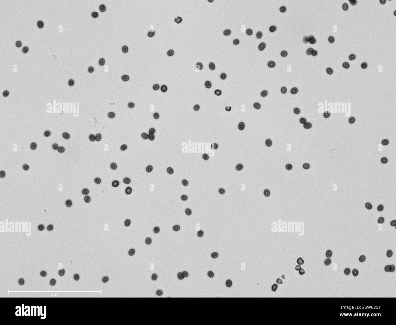 Pflasterpilz (Agaricus bitorquis), Fungi, Charles St, Cambridge, MA, US, wächst aus einem Riss zwischen dem Bürgersteig und einer Wand 15 cm Kappendurchmesser Brauner Sporendruck durchschnittlicher Sporendruck 4.9μm x 4.3μm Stockfoto