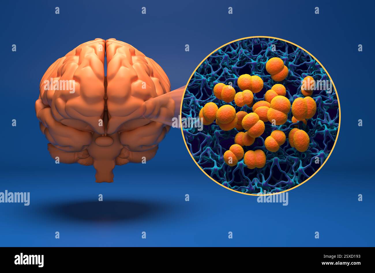Neisseria meningitidis (Meningococcus)-Bakterien im Gehirn (Meningitis-Infektion) - 3D-Darstellung einer isometrischen Ansicht Stockfoto