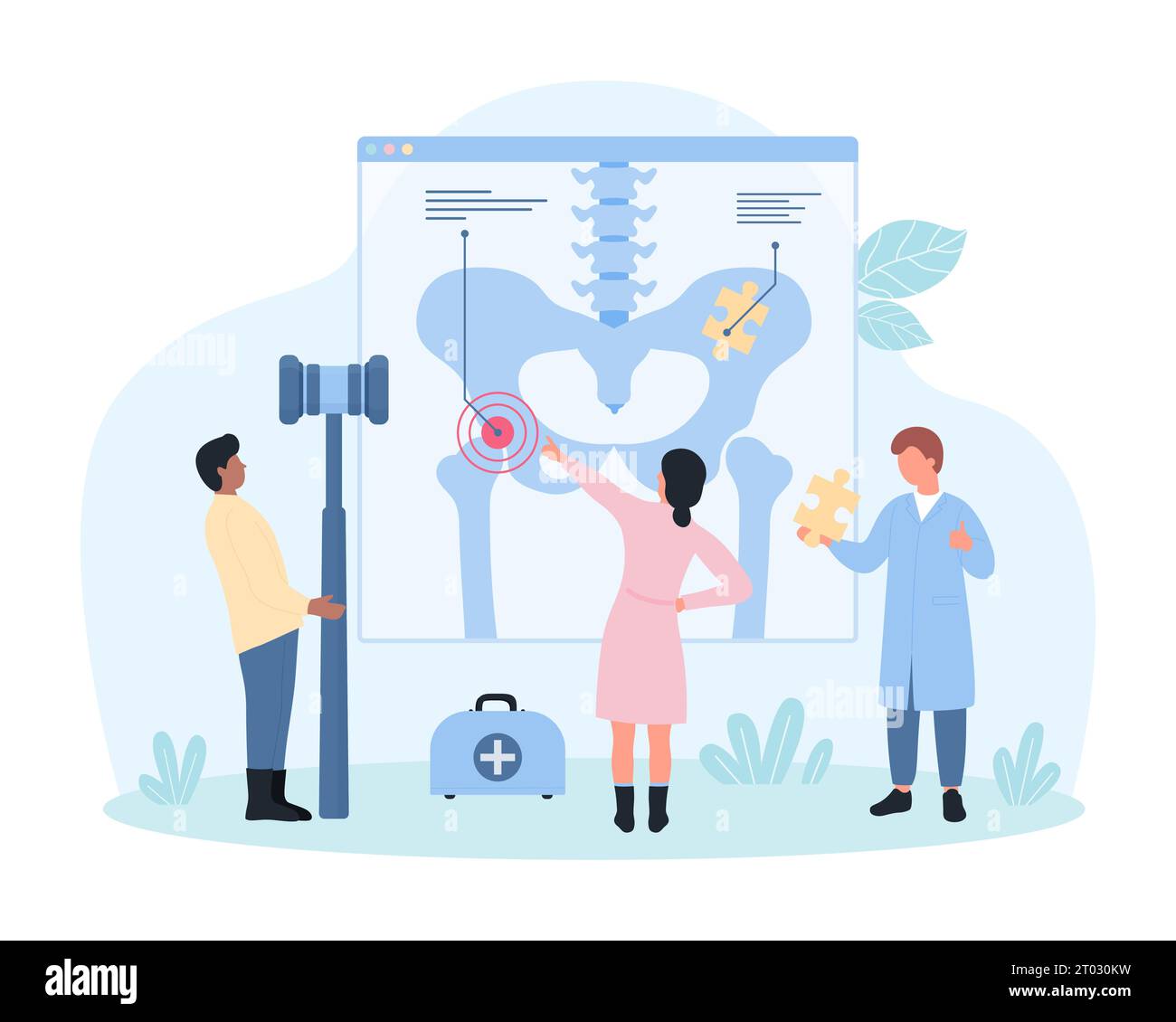Osteoporose, Diagnostik, Behandlung und Rehabilitation in der Rheumatologie Vektorillustration. Cartoon winzige Leute studieren menschliches Hüftgelenk auf medizinischer Anatomie-Chart, Orthopäden halten Knochen-Kalzium-Puzzle Stock Vektor